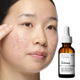 The Ordinary Aloe 2% + NAG 2% Solution 30ml