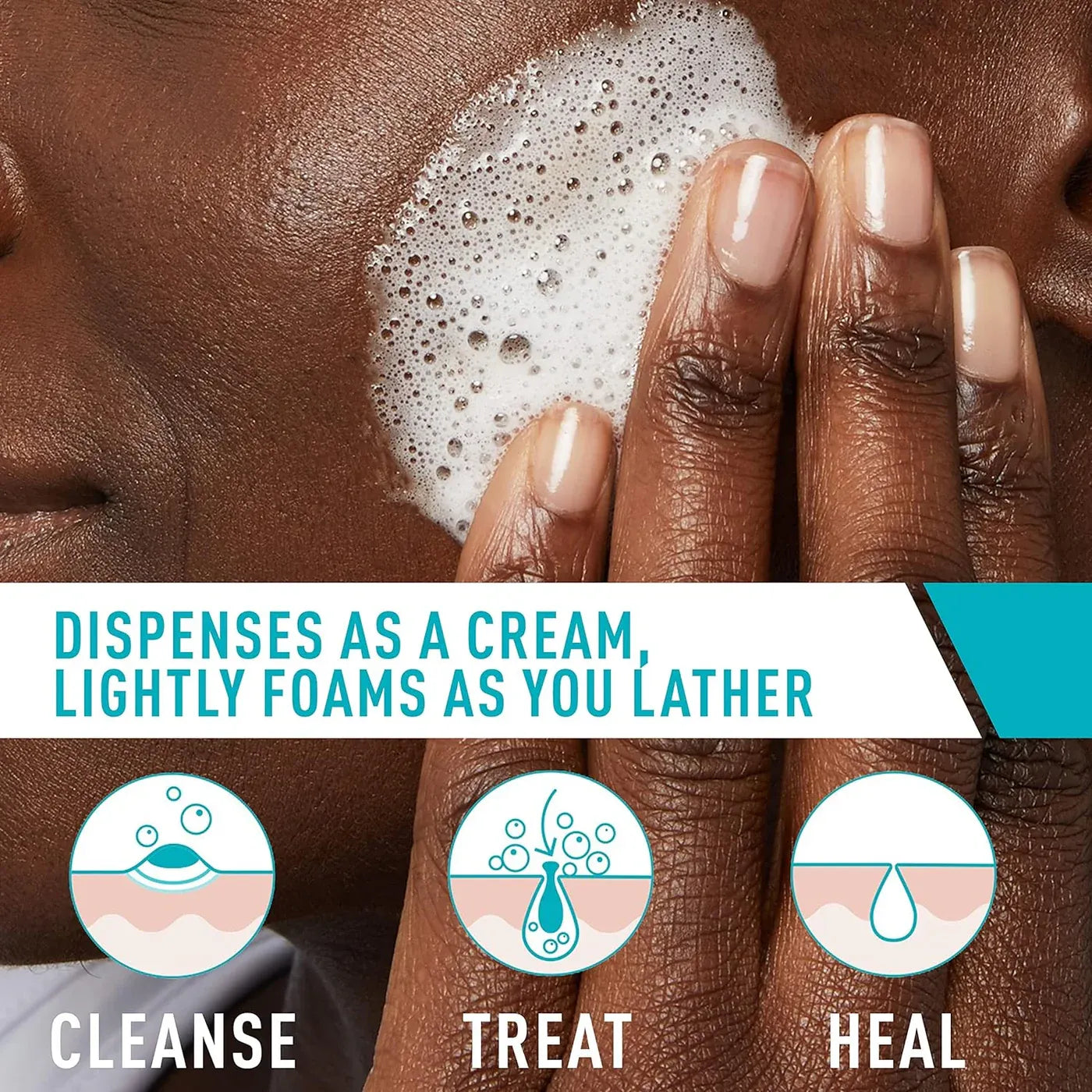 Cerave Acne Foaming Cream Cleanser 150ml